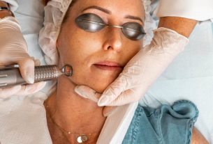 Things To Know About Hyperpigmentation Treatment