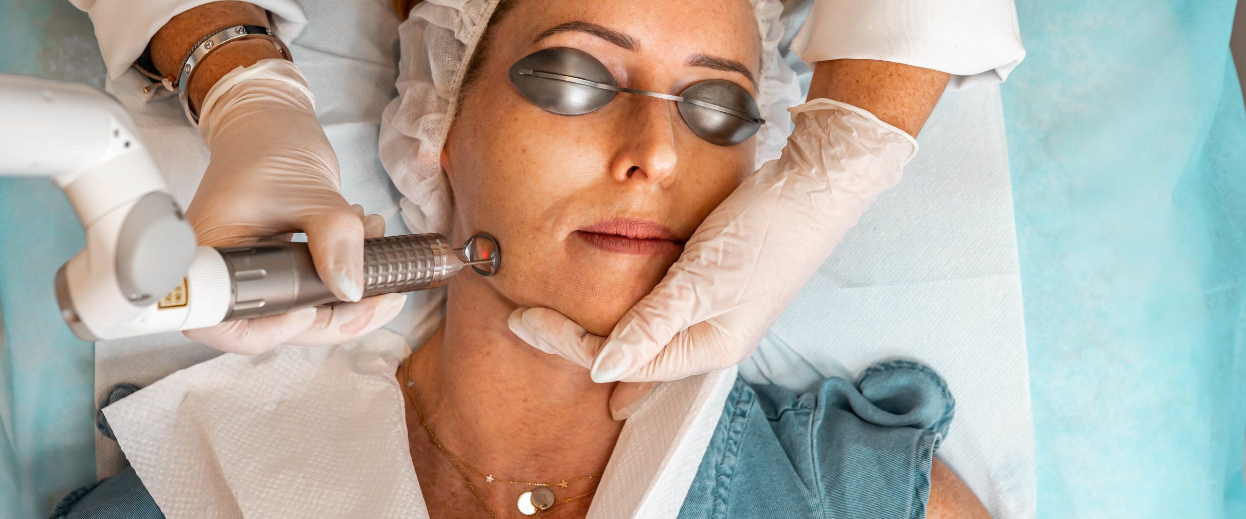 Things To Know About Hyperpigmentation Treatment